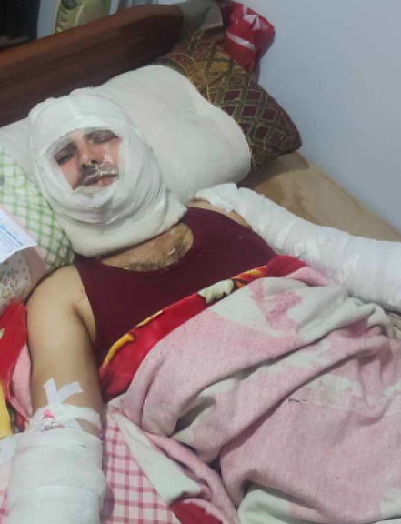 حرق حيًا لأجل منزل.. زوجة المجني عليه تكشف التفاصيل للموجز اليوم